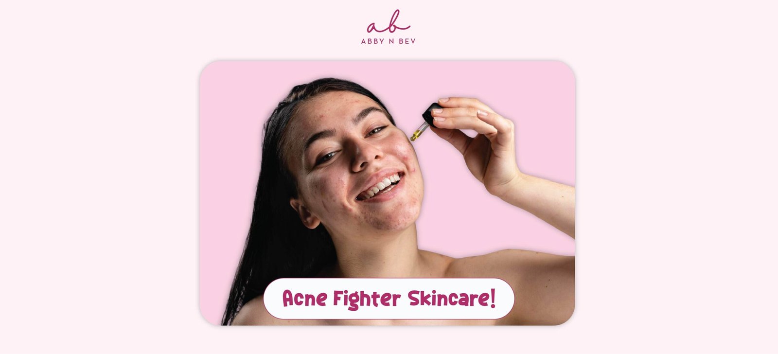 Kandungan Skincare Terbaik untuk Acne Skin: Centella, Allantoin, dan Calendula, Seperti Apa Perbedaan dan Manfaatnya?
