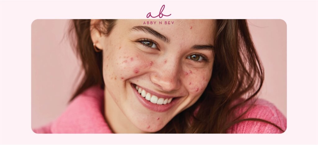 rekomendasi skincare anti jerawat untuk anak sekolah - abby n bev toko kosmetik makeup dan skincare