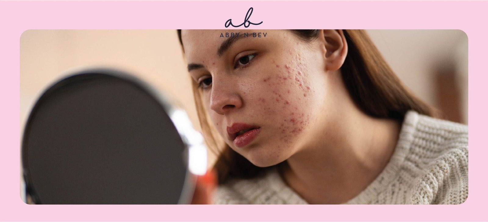 skincare untuk skin barrier rusak - abby n bev toko kosmetik makeup dan skincare