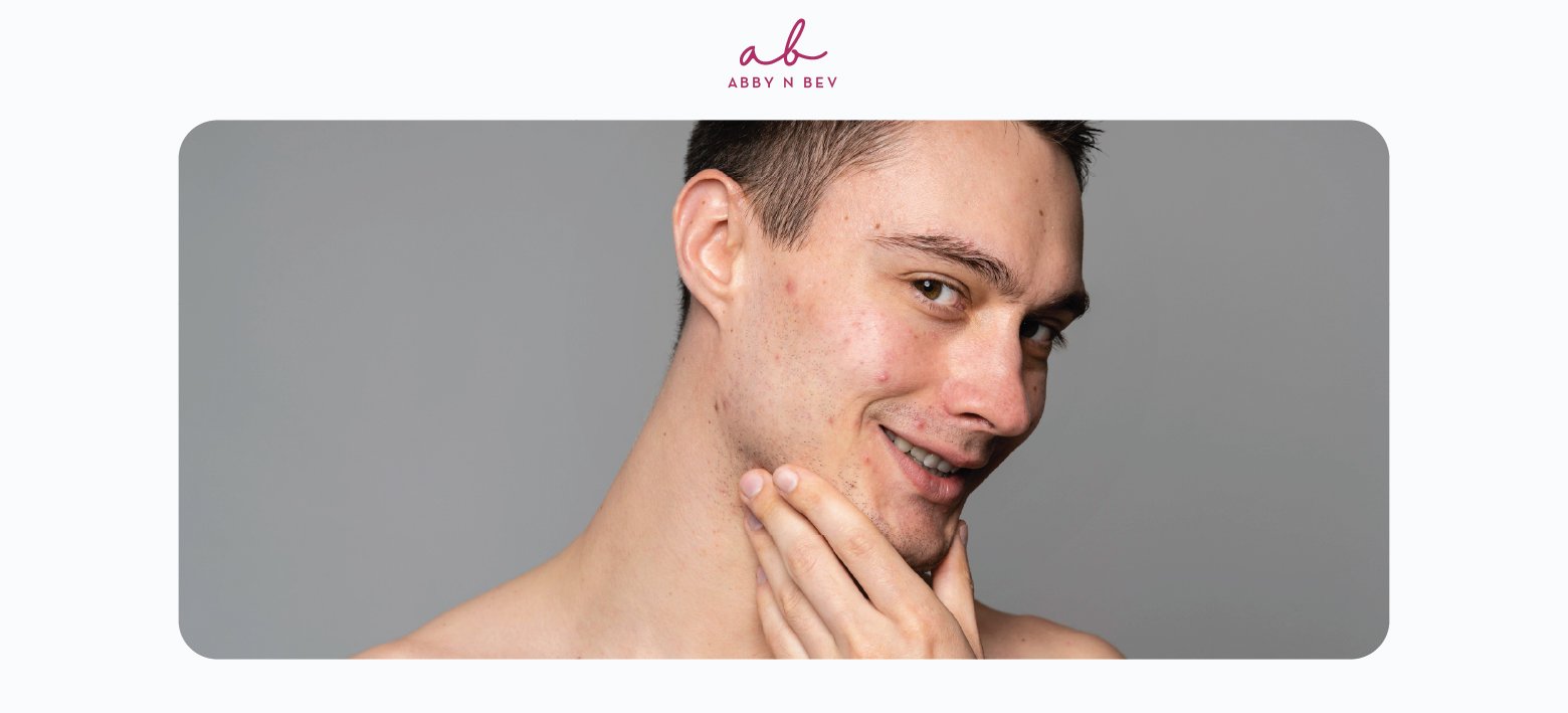 Jangan Asal Pakai Skincare, Begini Cara Mengatasi Kulit Beruntusan untuk Cowok!