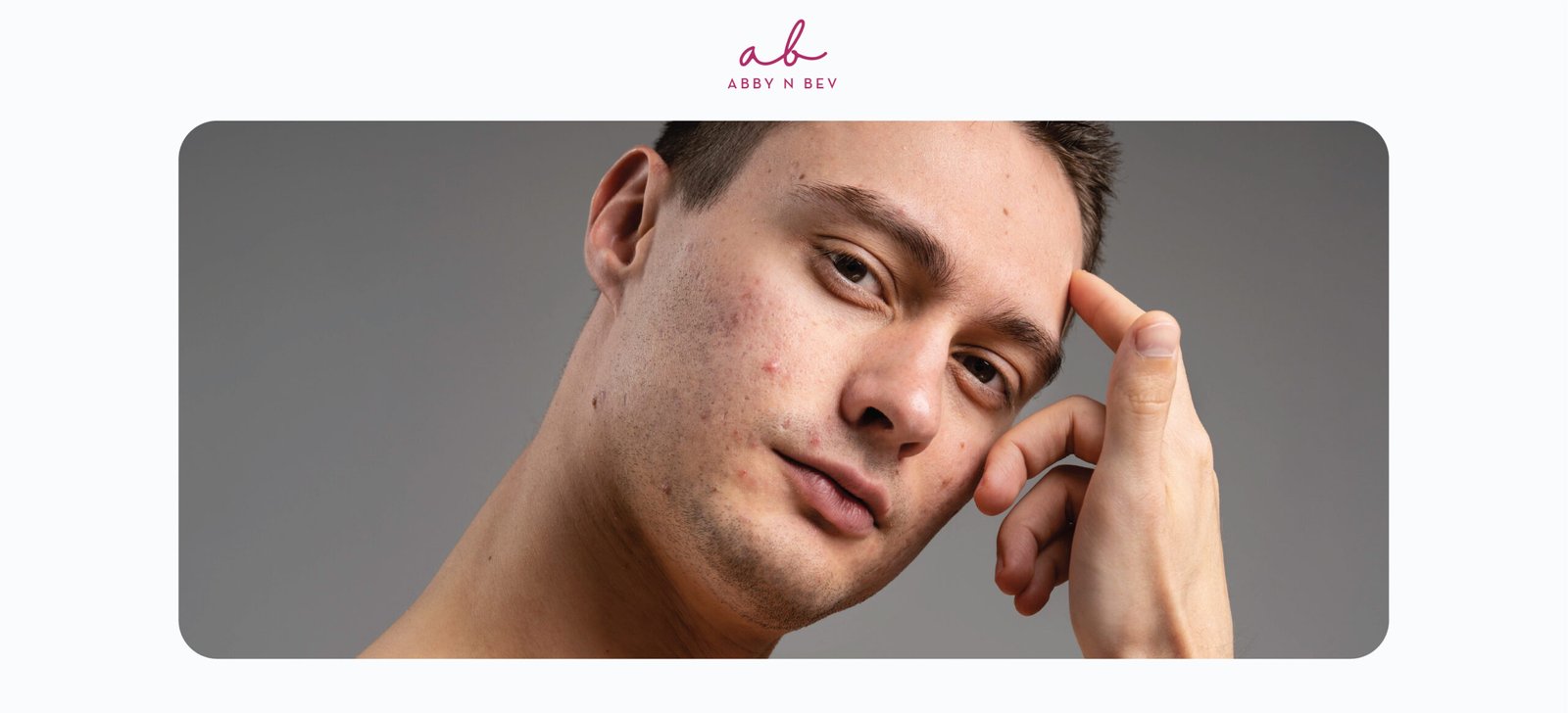 tips memilih skincare cowok kulit sensitif - abby n bev toko kosmetik bandung