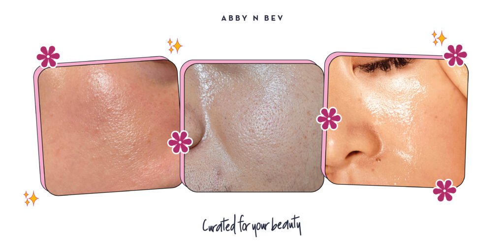 Abby n Bev - Beauty Online Store Terlengkap - 4 Penyebab Kulit Berminyak