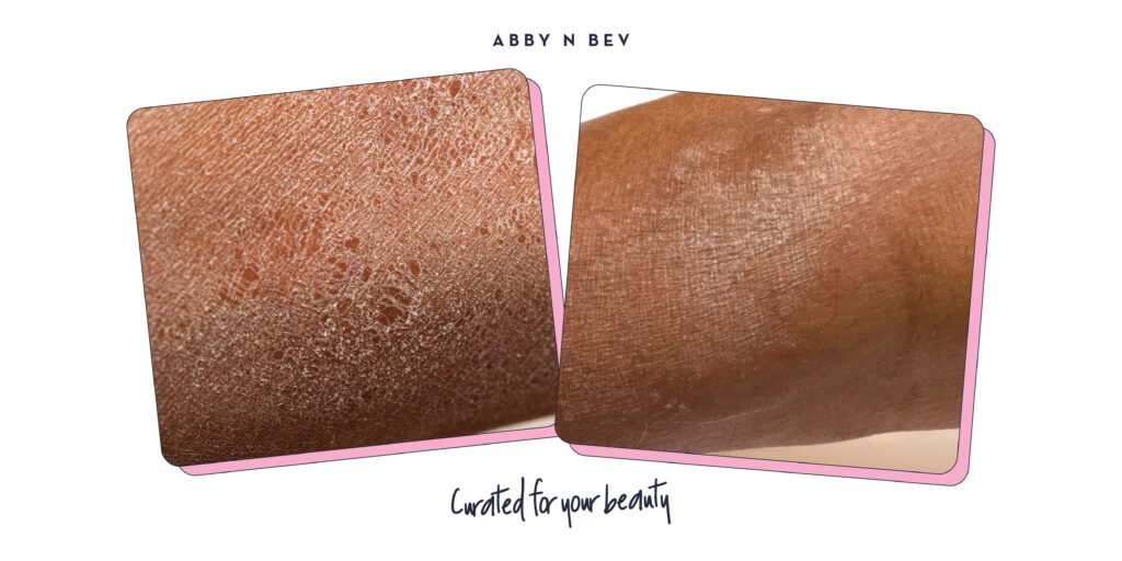 Abby n Bev - Beauty Online Store Terlengkap - Penyebab Kulit Kering