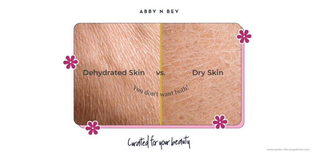 Abby n Bev - Beauty Online Store Terlengkap - Kulit kering ada dua jenis