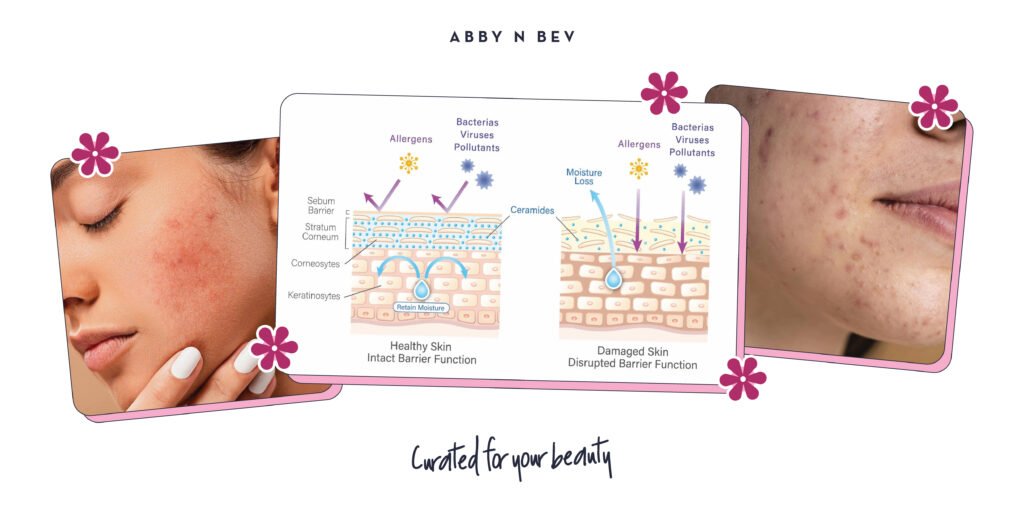 Abby n Bev - Beauty Online Store Terlengkap - Penyebab kulit kering_ berminyak dan berjerawat