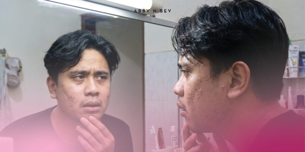 Abby n Bev - Beauty Online Store Terlengkap - Tanda-Tanda Cowok Harus Pake Skincare